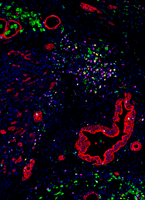 Vanessa news release