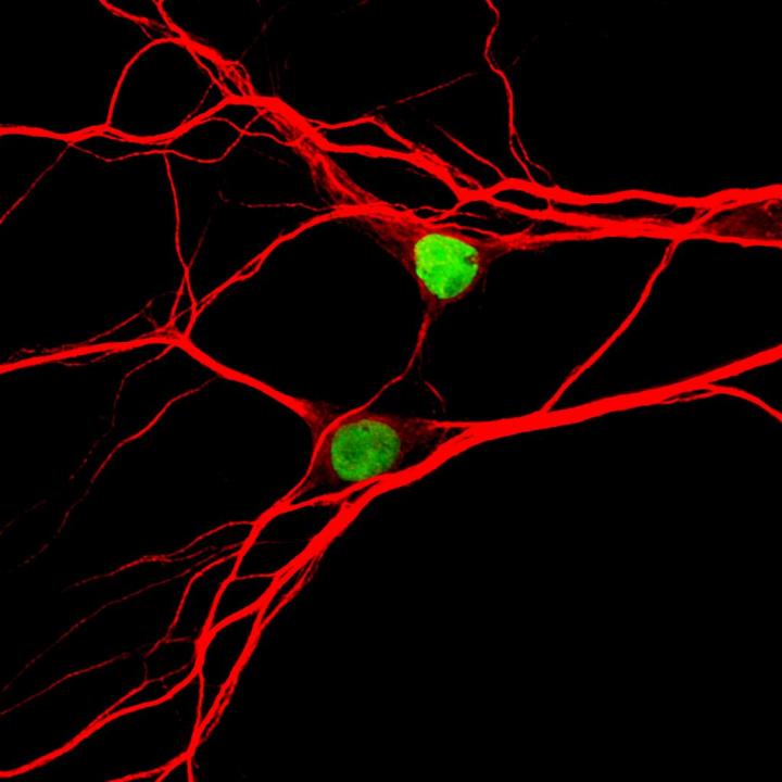 Neurons Expressing Topoisomerase-1