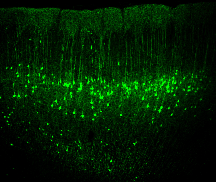 New findings on neuronal activities in the sensorimotor cortex
