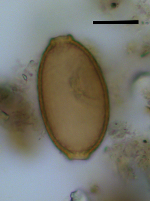 parasites in stool microscope