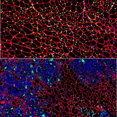 Muscle Regeneration in Experimental Model of DMD