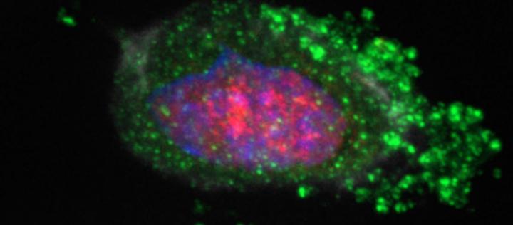 Gastric Epithelial Cells Infected with H. Pylori