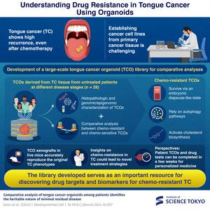 Understanding Drug Resistance in Tongue Cancer Using Organoids