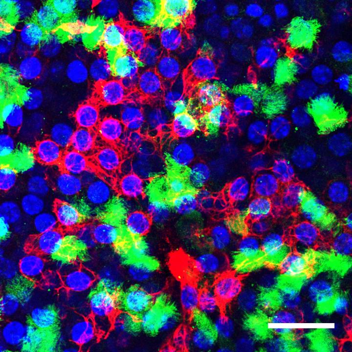 Club Cells of the Lung