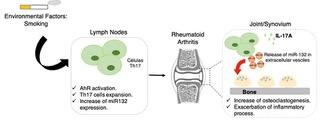 Bone erosion in rheumatoid arthritis