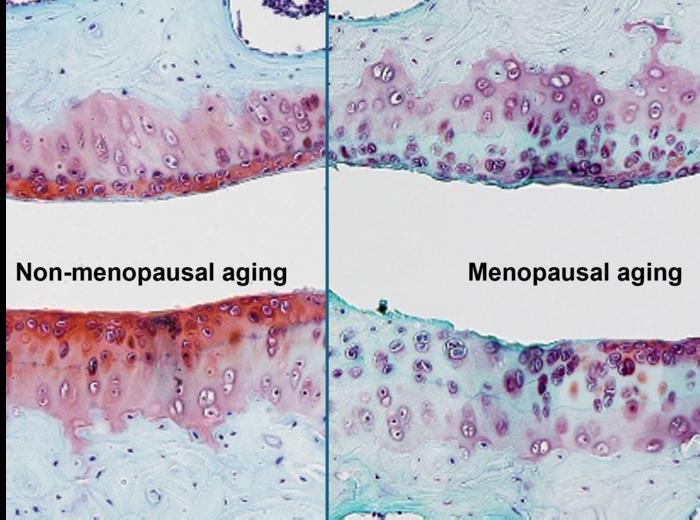 Non-menopausal and menopausal cartilage comparison