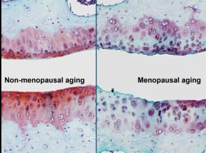 Non-menopausal and menopausal cartilage comparison