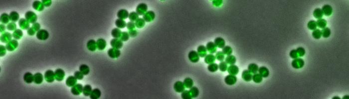 Daptomycin Binds to Certain Areas of the Cell Envelope