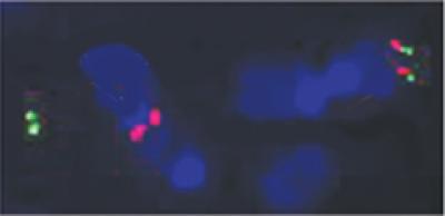 When DNA Repair Goes Awry