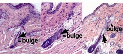 New Hair Follicle Generation