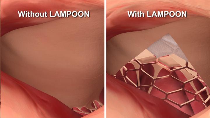With and without LAMPOON
