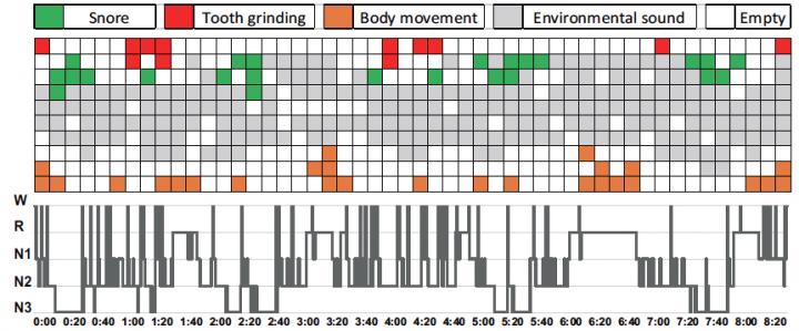 Figure Sleep Pattern Visualization by AI Method