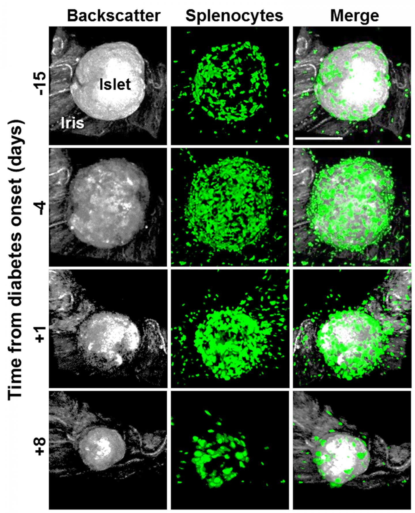 <em>In vivo</em> Imaging of Type 1 Diabetes Immunopathology Using Eye-Transplanted Islets (1 of 2)
