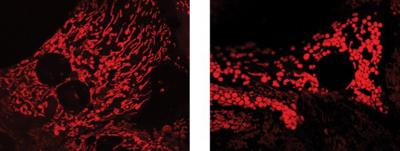 Healthy Mitocondria vs Pathologic