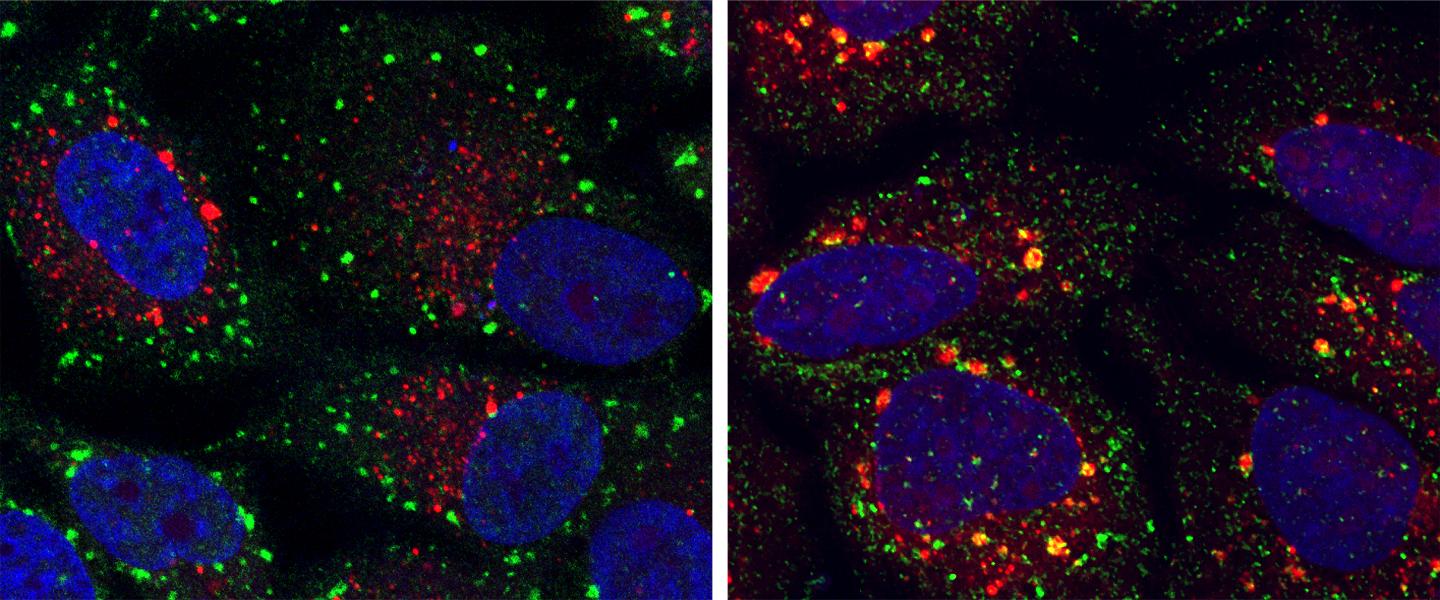 Cells with Granules