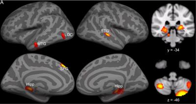 Brain Scan [IMAGE] | EurekAlert! Science News Releases