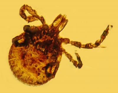 Tick Carrying Lyme Spirochetes