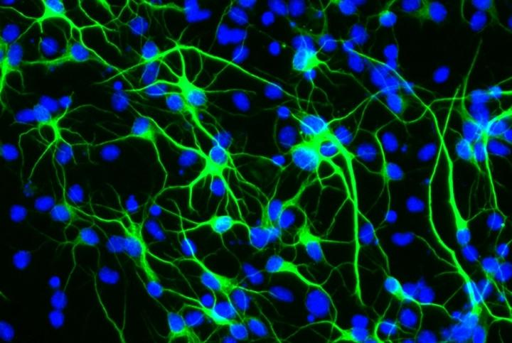 Antioxidant treatment boosts the birth of new neurons from stem cells by suppressing stress signaling