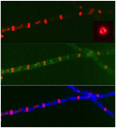 Constriction Rings in Dividing Bacteria
