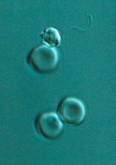 Malaria Sperm Cell
