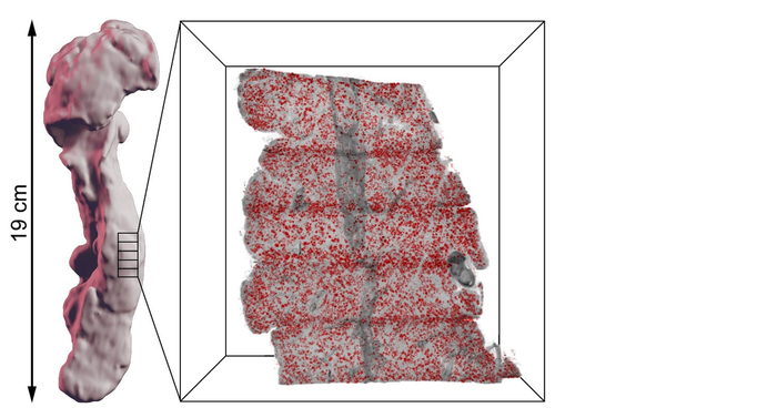 Illustration pancreas 3D