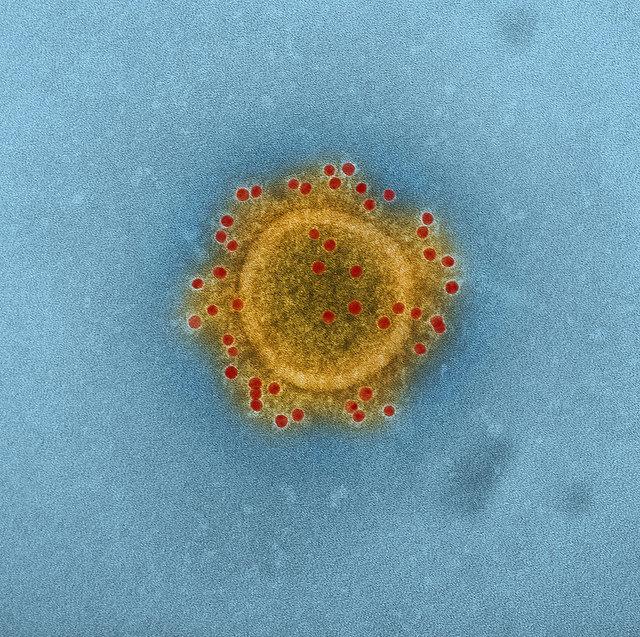 Colorized Micrograph of MERS Coronavirus