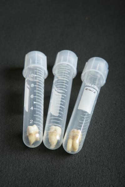 Primate Teeth
