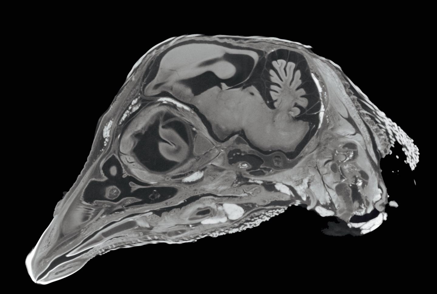 Diffusible Iodine Contrast-Enhanced (Dice) CT Imaging