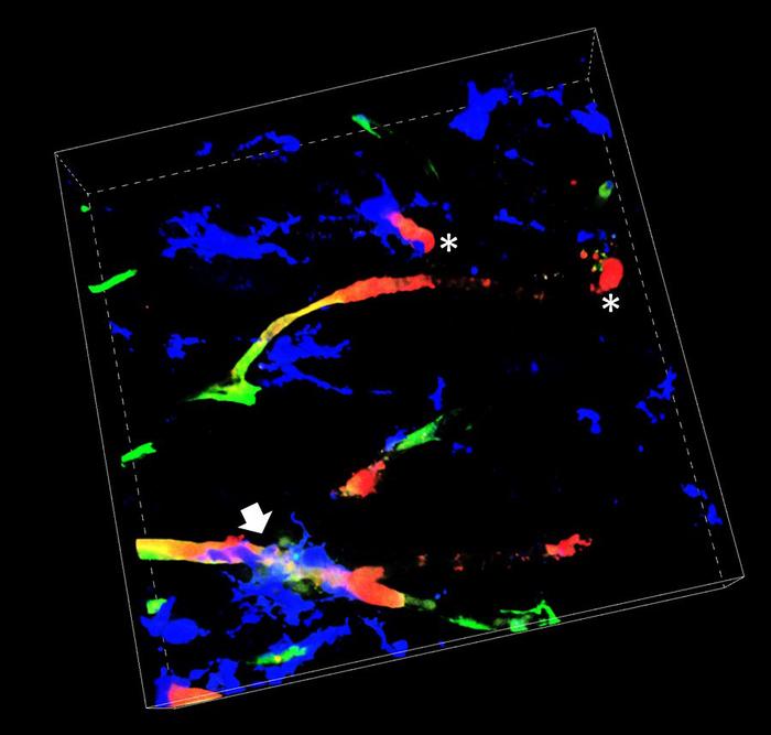 Confocal imaging