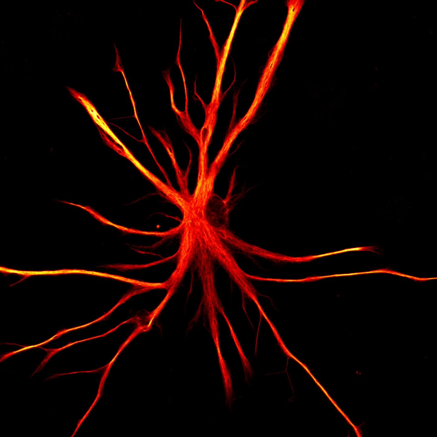 Human Astrocytes