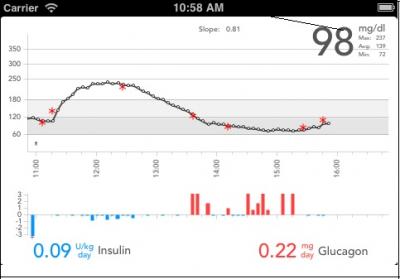 Bionic Pancreas Readings For Blood Glucose, Insulin and Glucagon Dosage