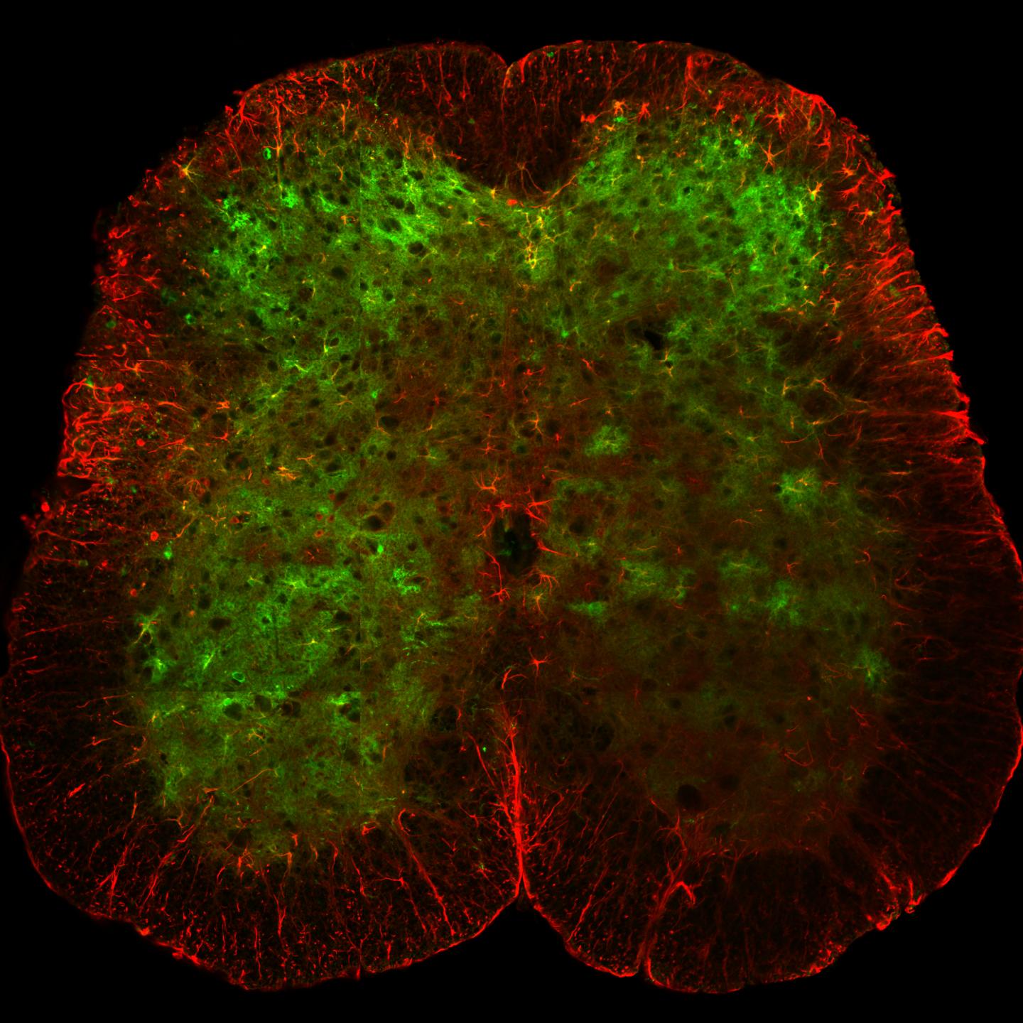 Salk Imaging Technologies Offer New Window into Spinal Cord