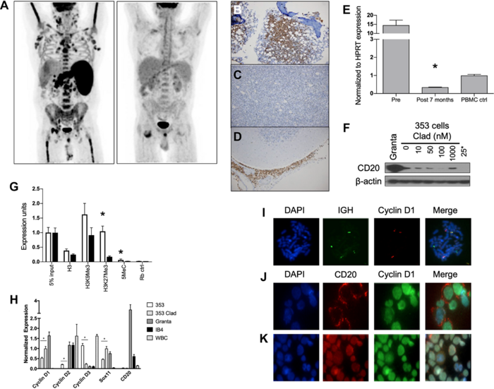 Oncotarget |  Epigenética e inmunogenética combinadas