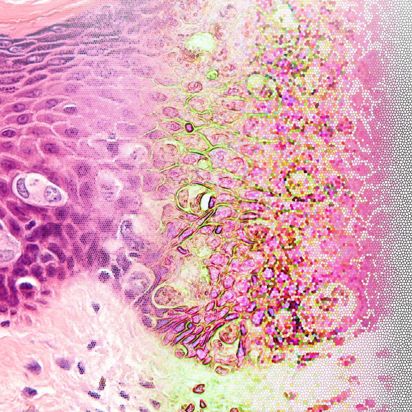 From Tissue Section to Data for Computer-Based Interpretation