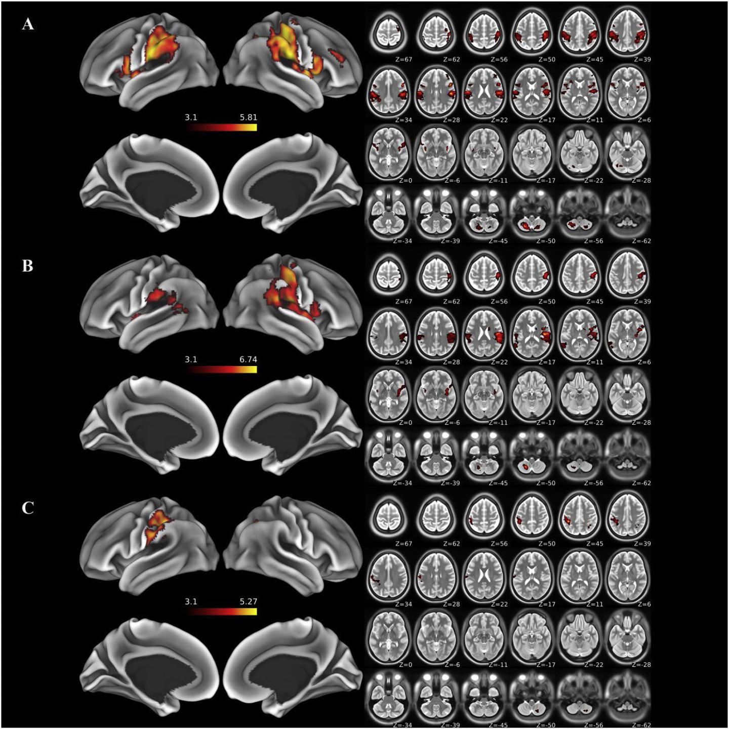 Functional MRI Results