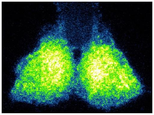 CLOCK Gene [IMAGE] | EurekAlert! Science News Releases