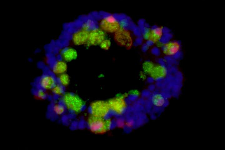 Gut organoids