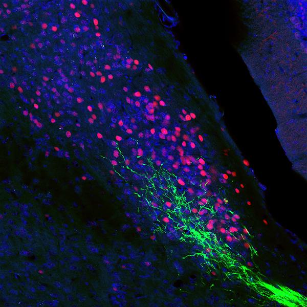 Sensory Neurons Wired Directly to Brain's PBL