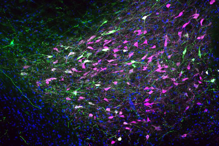 Rat brain neurons