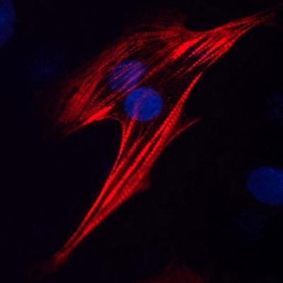 Immunofluorescent Monoclonal Antibody Staining of Cardiac Troponin T in Human Fetal Cardiomyocytes