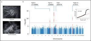 Genome-wide association studies of hair whorl direction identified four significant signals