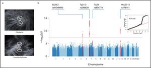 Genome-wide association studies of hair whorl direction identified four significant signals