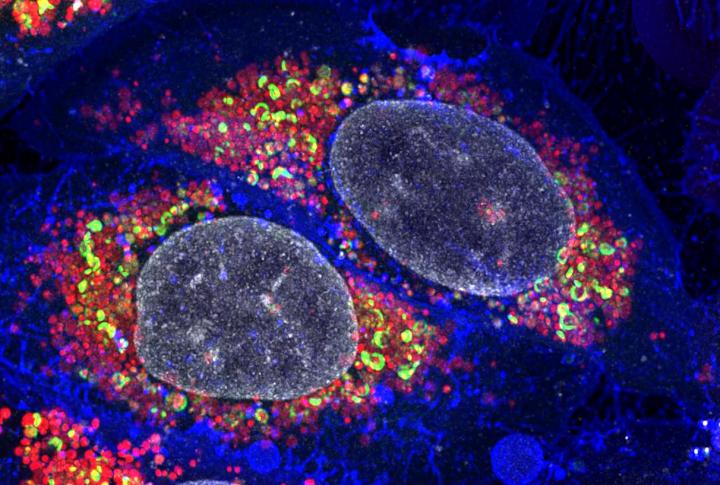 Damaged Mitochondria Targeted by Autophagy Receptors