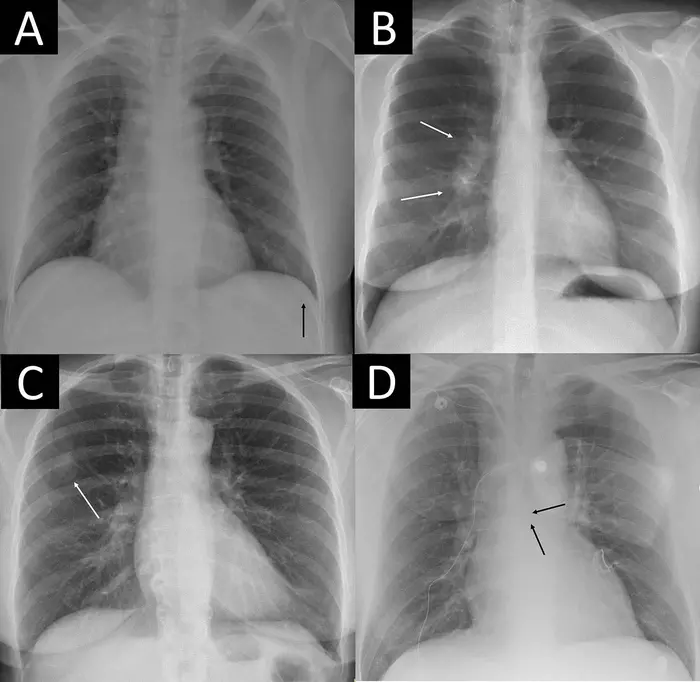 four-examples-of-remarkable-ch-image-eurekalert-science-news-releases
