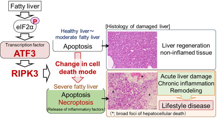 Figure. Schematic diagram of induction mechanism of acute and chronic liver damage in severe fatty liver