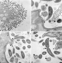 Electron Microscopy Images of Deianiraea Bacteria on the Surface of Paramecia Cells