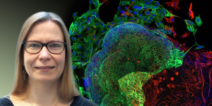 Searching for clues as to why chemotherapy doesn't always work