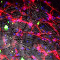 Neurons on Scaffold