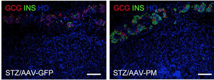 Gene Therapy for Mouse with Type 1 Diabetes