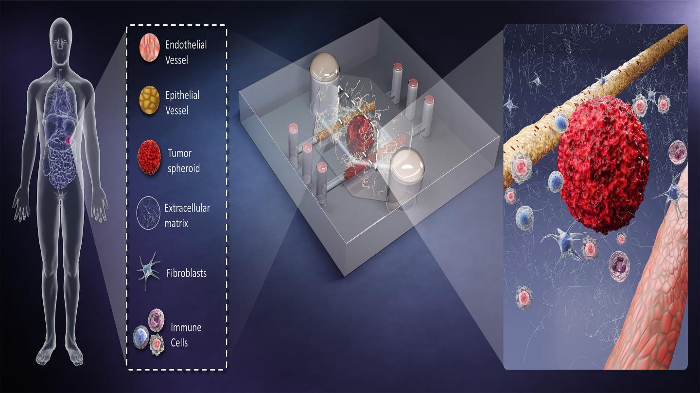 Potential of BMOMs for precision medicine